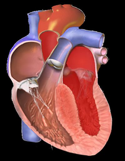 Кардиомиопатичное сердце